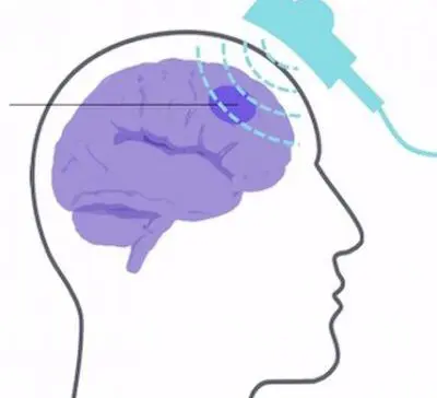 tms web site 400x400 1